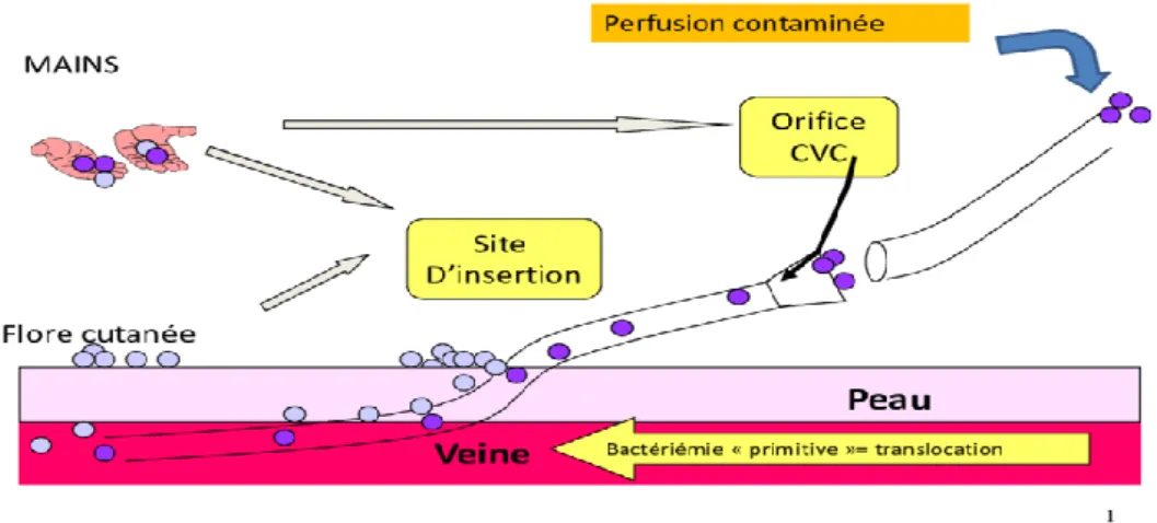 Figure 9 : Modes de colonisation des cathéters veineux centraux [2] 