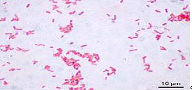 Figure 4: E coli coloration de Gram x 100 [16]. 