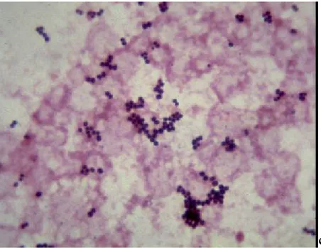Figure 6: Staphylococcus saprophyticus en amas [20]. 