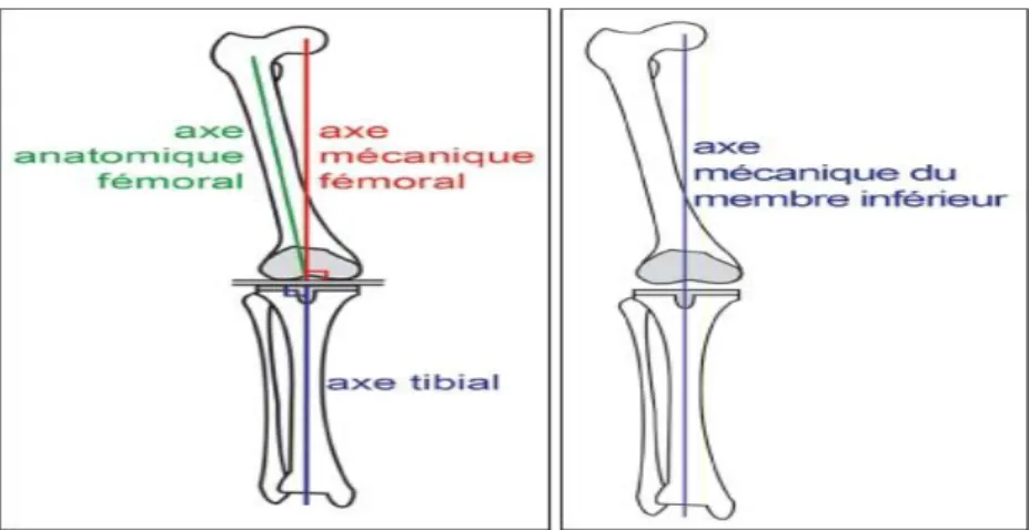 Fig 13 :Les critères d’implantation correcte d’une PTG   dans le plan frontal sur goniométrie en charge sont les suivants : 