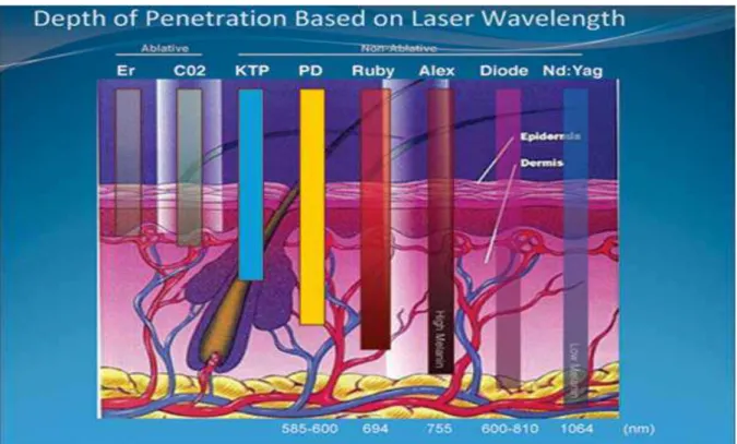 Figure 14 : La profondeur de pénétration des différents lasers dans la peau 