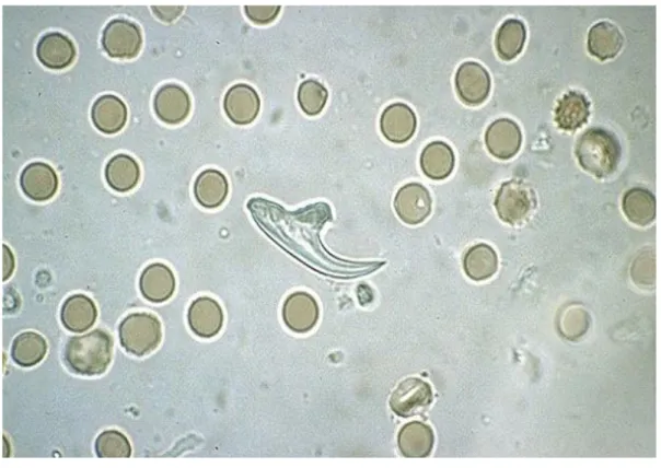 Figure 9 : Sable hydatique avec crochets  [22] . 