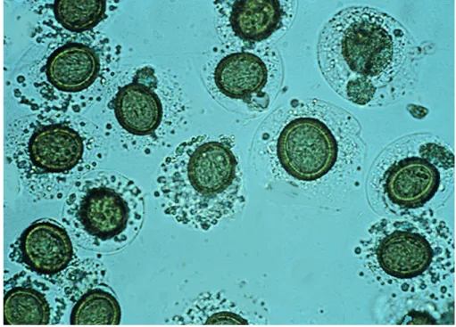 Figure 9: Embryophores d’Echinococcus Granulosus. 