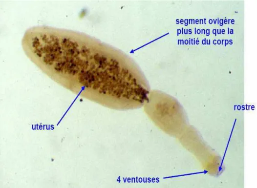Figure 9: Adulte d'Echinococcus granulosus [57] 