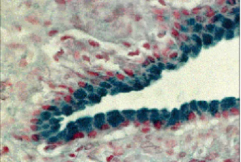 Fig 10 : Épithélium d'un cystadénome mucineux (CM) parfaitement bénin.  