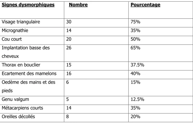 Tableau 4 : Répartition des patientes  turnériennes en fonction des signes         dysmorphiques