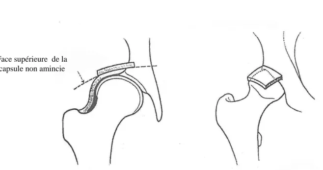 Fig. 10 : Position  de la  butée Face supérieure  de la 