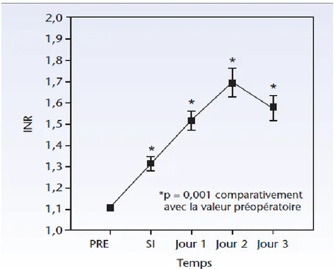 Figure 6: Evolution de l’INR après hépatectomies [36]. 