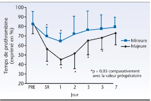 Figure 7 : Evolution postopératoire du taux de prothrombine (hépatectomie  majeure versus hépatectomie mineure) [37]