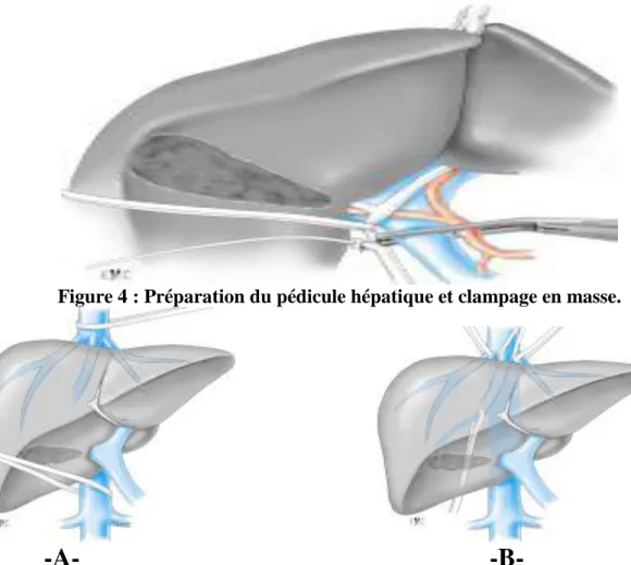 Figure 5 : Contrôle vasculaire 