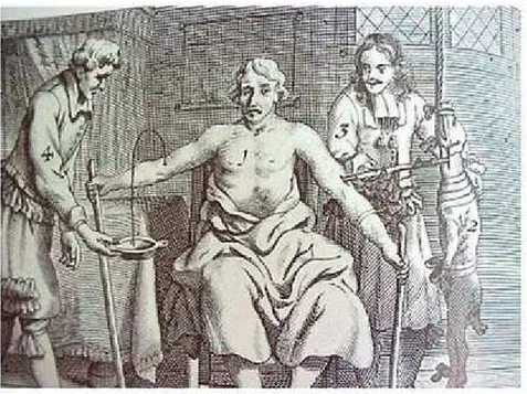 Fig. 2 : Jean Scultet : Transfusion de sang d’agneau (1671) 