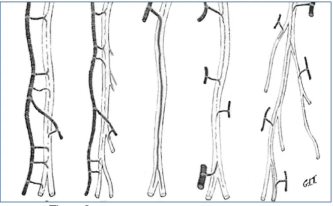 Figure  9: Classification de la vascularisation des nerfs  périphériques en fonction de leur sécurité microvasculaire [ 17] 