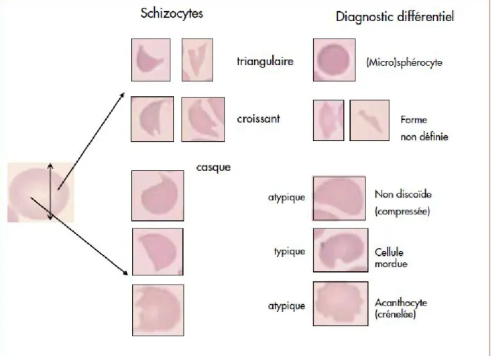 Figure 8. Images de référence pour l’identification des schizocytes [112] 