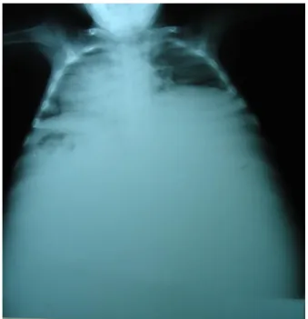 Figure 13: Radiographie thoraco-abdominale 