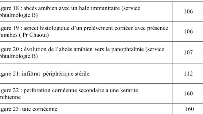 Figure 18 : abcès amibien avec un halo immunitaire (service 