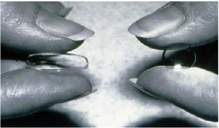 Figure 9: lentille souple et rigide 