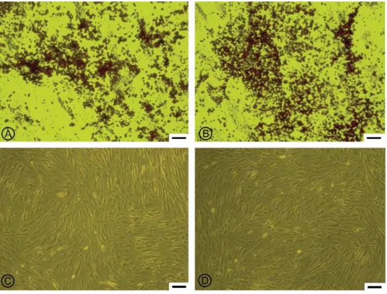 Fig 5: Differentiation adipocytaire des MSC à partir du  tissue adipeux(A)  et de la moelle  osseuse(B)