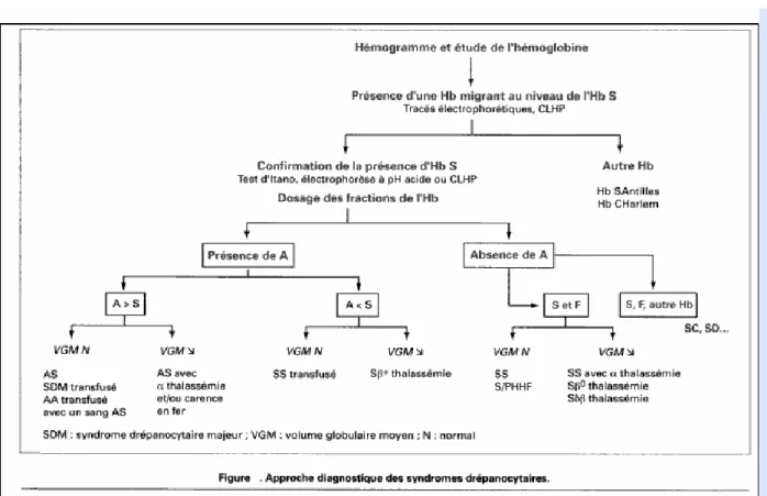 Tableau : approche diagnostique des syndromes drépanocytaires. 