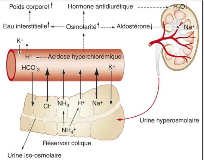 Figure 2 : Mécanisme présumé de l’acidose hyperchlorémique dans les réservoirs  coliques