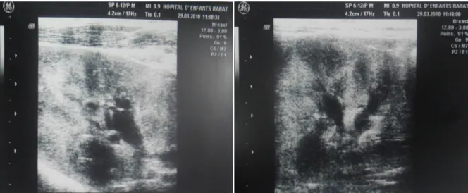 Figure 3 : image d’échographie abdominale : 