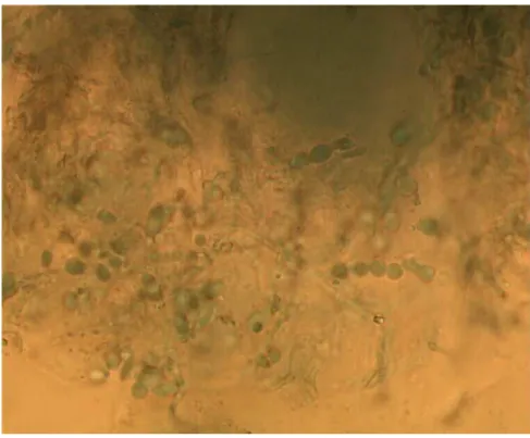 Figure 7 : Arthroconidies en tonnelets  [Photo du service de parasitologie, HMIMV] 