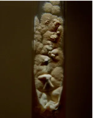 Figure 9 : Aspect macroscopique de Scopulariopsis brevicaulis sur Sabouraud   [Photo du service de parasitologie, HMIMV]