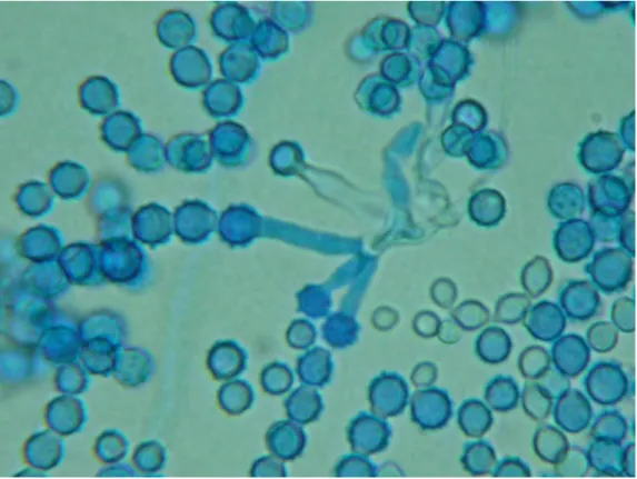 Figure 10 : Annelospores rugueuses de Scopulariopsis brevicaulis sur Sabouraud   [Photo du service de parasitologie, HMIMV] 