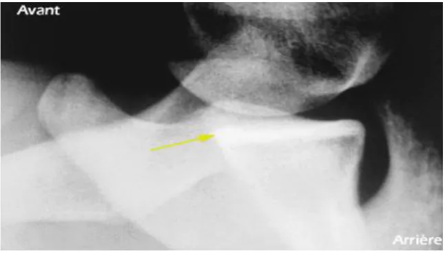 Figure 8 : PROFILE DE BERNAGEAU 