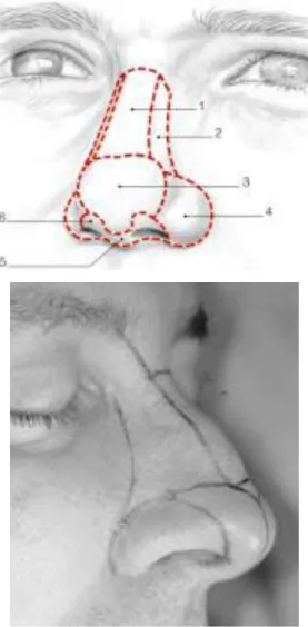 Figure 4 [12]: Les sous-unités esthétiques du nez : 