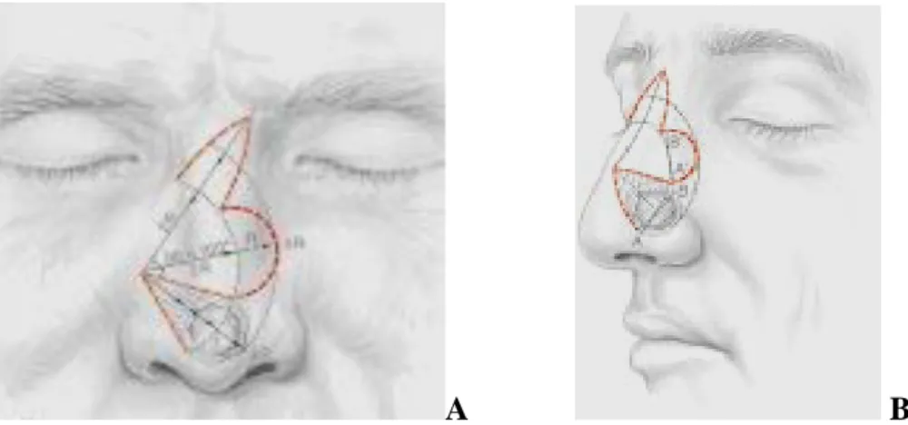 Figure 15 [126] : Lambeau bilobé revu par Zitelli. 