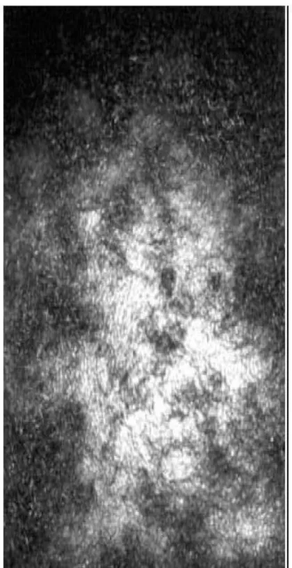 Figure 3 :aspect  de poulet plumé - teigne à M.canis 