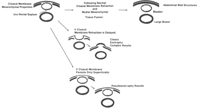 Figure 1: Les événements embryologiques survenant au cours du développement des  couches de la paroi abdominale antérieure basse sont schématiquement représentés  pour le foetus normal (en haut), le complexe d’exstrophie classique (au milieu), et la 