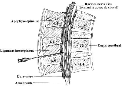 Figure 2: PONCTION LOMBAIRE [16]