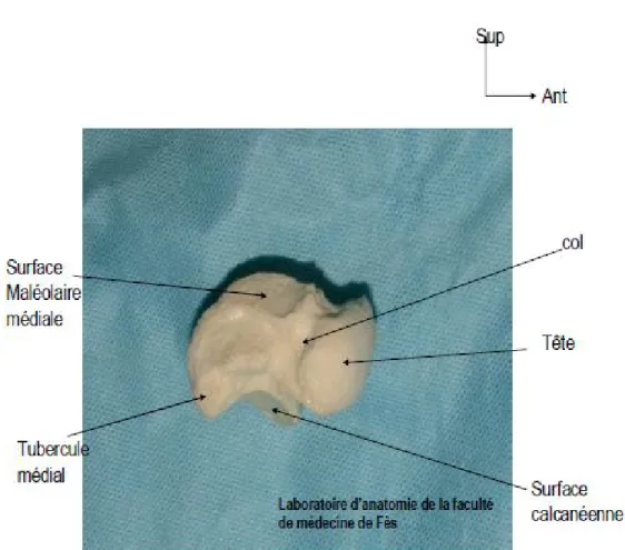 Figure 4 : Vue médiale du talus (29). 