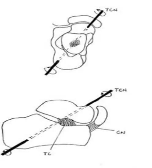 Fig. 10 : L’axe de HENKE : 
