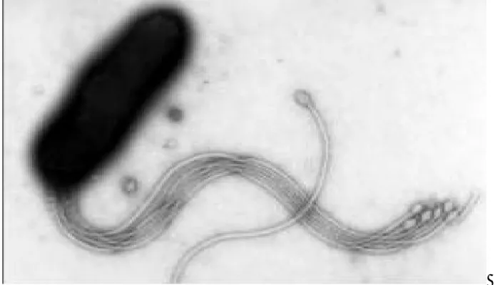 Figure 3: Morphologie d’ H. pylori en microscopie électronique [31]. 