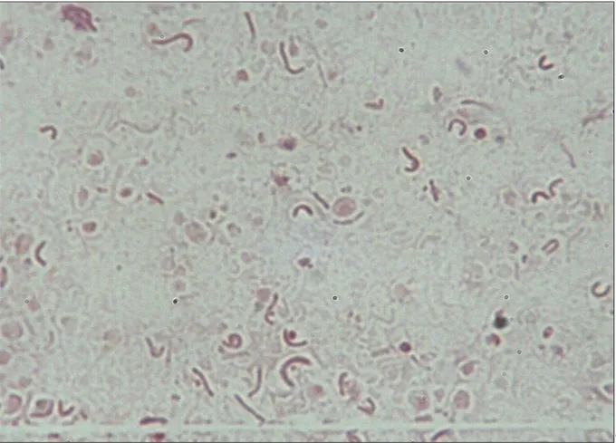 Figure 4: Examen microscopique d’une culture après coloration de Gram. H. pylori apparaît  sous diverses formes : bacillaire, incurvé, en U, en C ou en O [32]