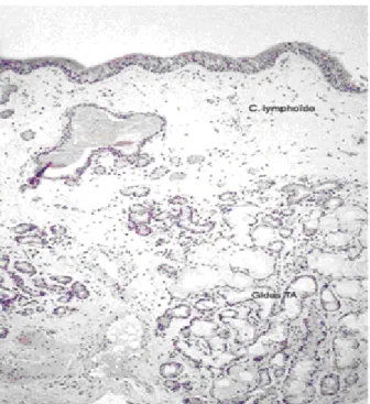 Figure 6.Coupe histologique d’une muqueuse de sinus maxillaire. 