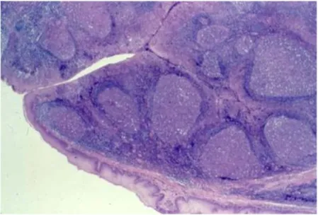 Figure 7. Coupe histologique d’amygdale palatine. Coloration HES. Faible  grossissement