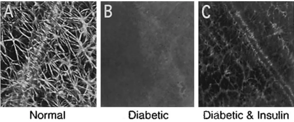 Figure n° 8 : Altération des astrocytes au cours du diabète agrandissement 200x  A : rétine de rat normal avec présence d’un processus astrocytaire  