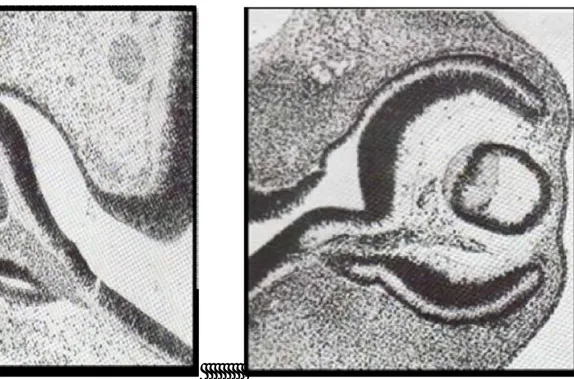 Figure 1-A: Globe oculaire d'un embryon de 9 mm       Figure 1-B : Globe oculaire d’un embryon de  (36-38 jours)                                                               11mm (39-41 jours) 