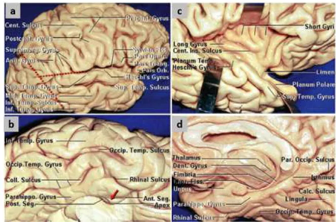 Figure  3:  Anatomical  landmarks  of  the  cortex  of  the  temporal  lobe.  Photographs  are  of  the  lateral (a), inferior (b), superior (c) surfaces and medial (d) on fixed cadaver[13]