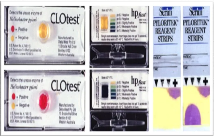 Figure 10: Exemples de trois tests commerciaux rapides d'uréase (RUT)  