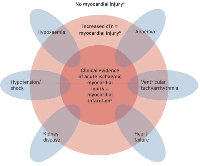 Figure 7 : Éventail de la lésion myocardique, allant de l’absence de lésion à l’infarctus du  myocarde[11] 