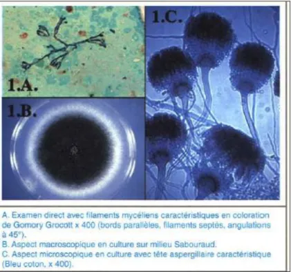 Figure 10 : Aspergillus fumigatus. [23] 