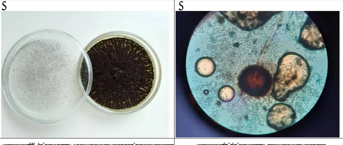 Figure 16: Aspect macroscopique de Aspergillus  niger : Couleur noirâtre Aspect granuleux  [Laboratoire central de Parasitologie-Mycologie 