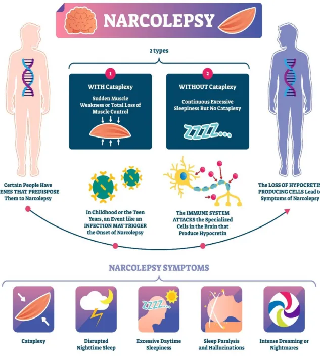 Figure 6: Illustration résumant les mécanismes induisant les signes de la narcolepsie  (SOURCE IMAGE : VECTORMINE) 