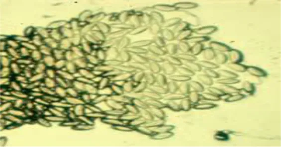 Figure 5 : Œufs d’Enterobius vermicularis vus sur un scotch test anal  grossissement ×100  [3’]