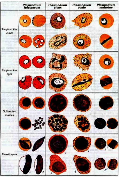 Figure 7 : Diagnostic du paludisme : Plasmodium à divers stades. Aspects sur  frottis minces  [78] 