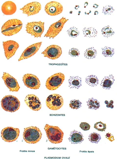 Figure 6 : Aspects morphologiques de  P. ovale [4] 